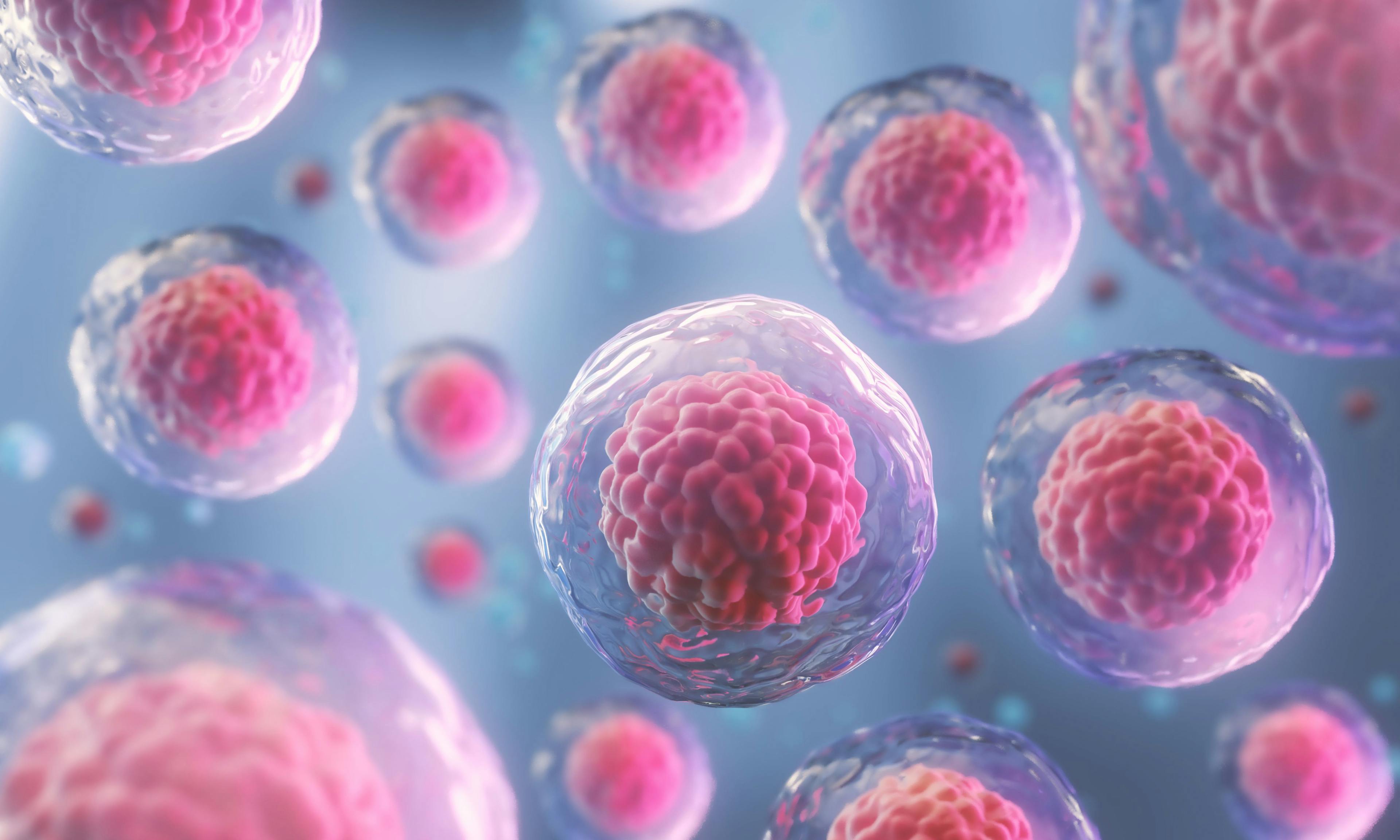 First Patient With MSLN-Solid Tumors Receives SynKIR-110 CAR T-Cell Therapy