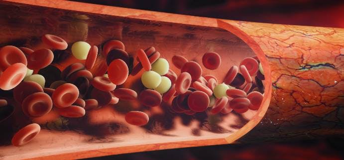 Hemophilia B Gene Therapy Shows Long-Term Ability to Reduce FIX Consumption 