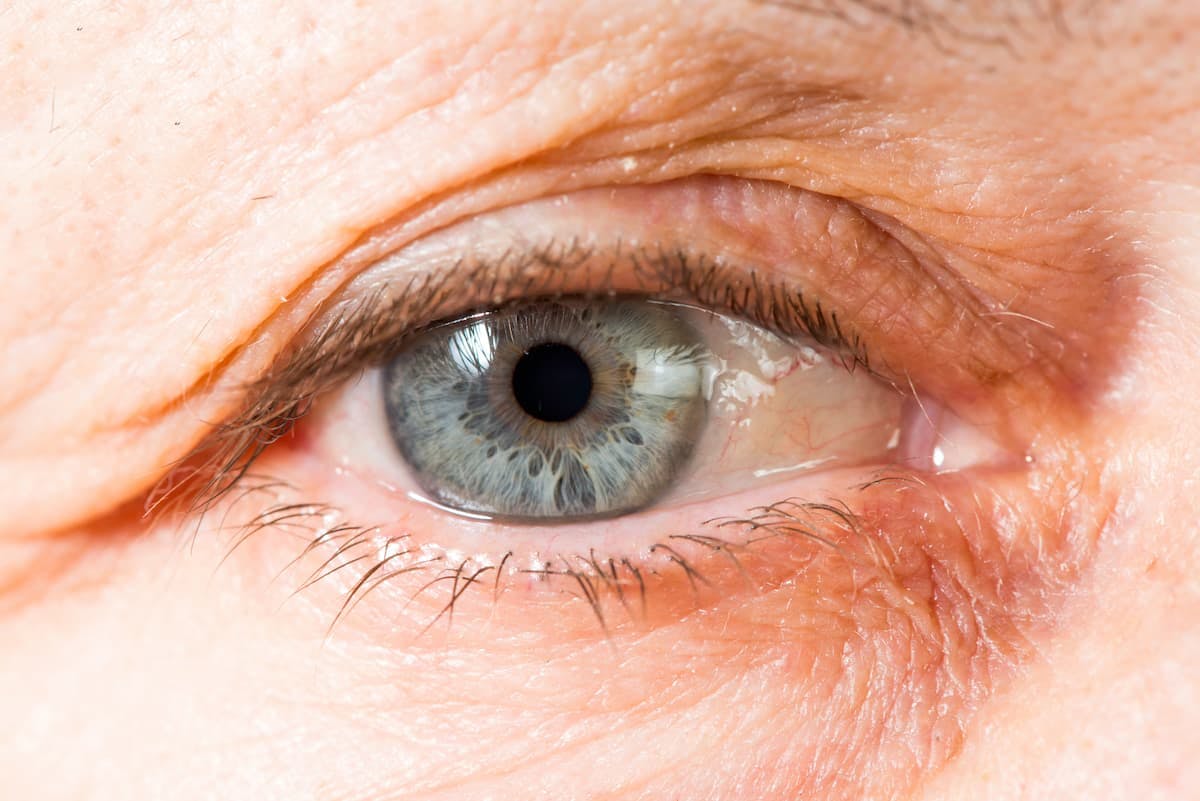 LCA2 Gene Therapy Shows Visual, Retinal Improvements at Low Doses 