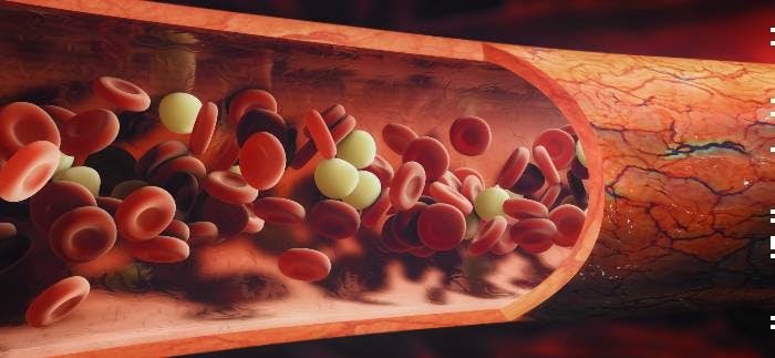 Roctavian Approved for Hemophilia A in the EU 