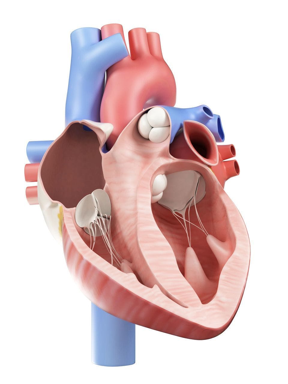 Heart Failure iPSC-Derived Therapy Trial Doses First Patient