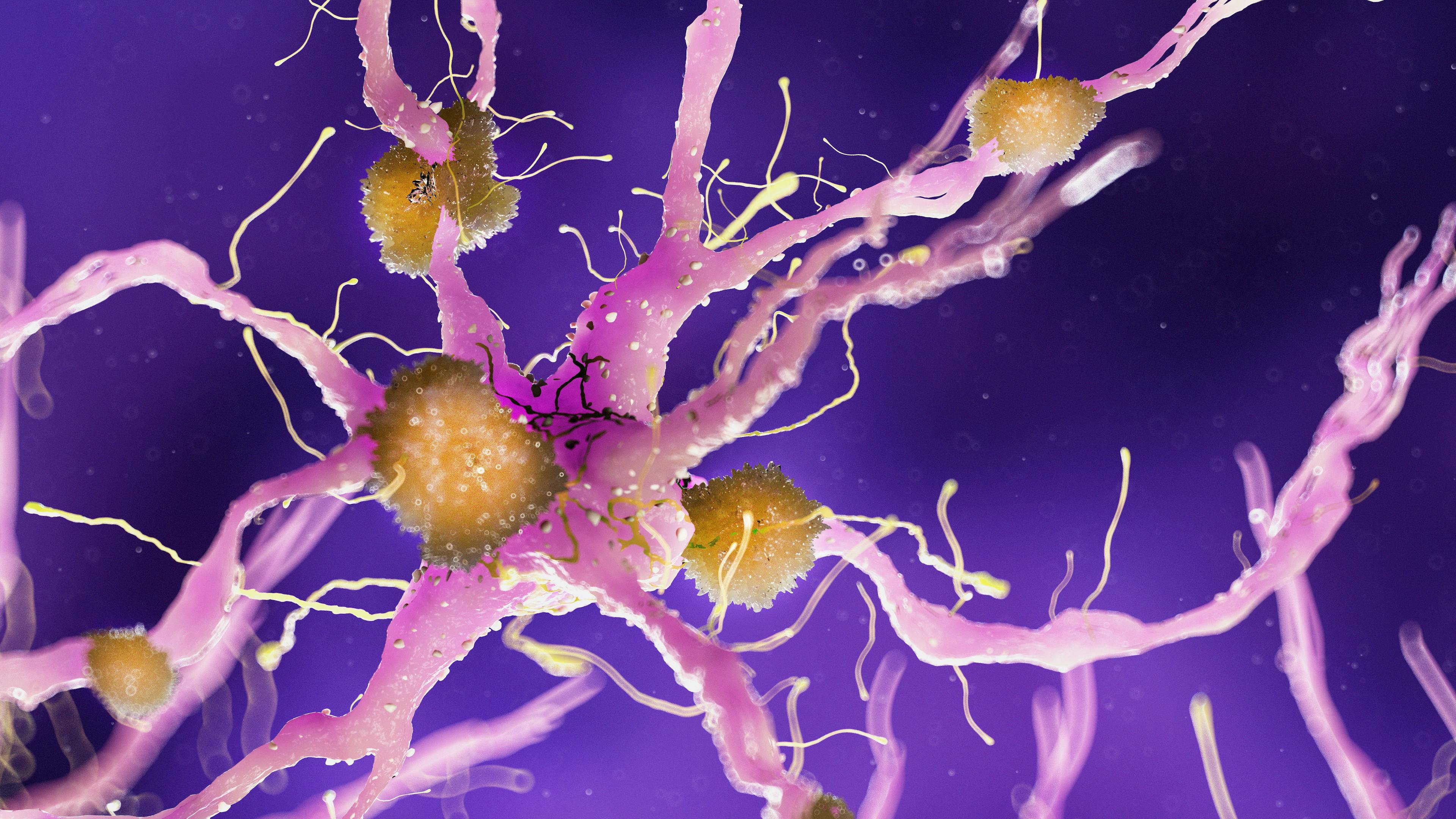 Autologous Adipose Stem Cells Safe in Alzheimer Disease, More Efficacy Data Needed