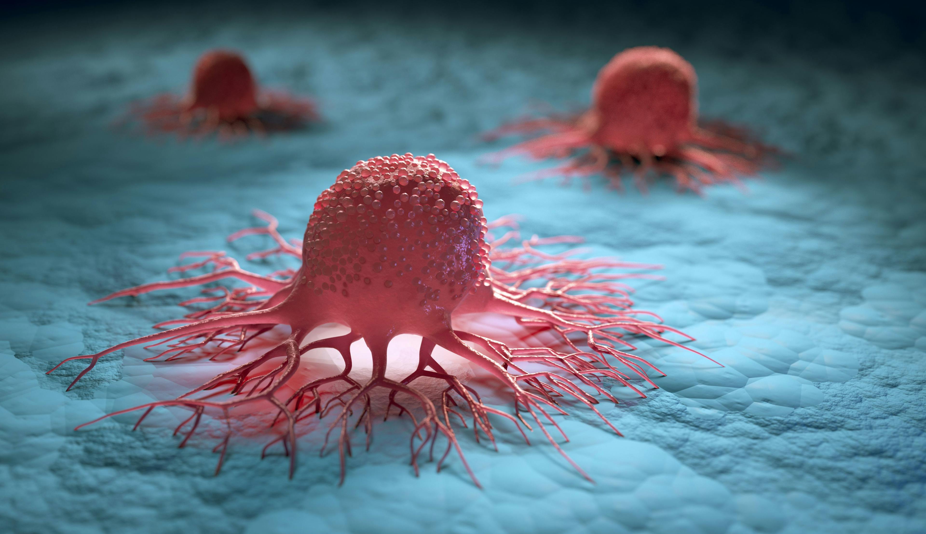 Advanced Solid Tumor CAR-T Therapy Trial Doses First Patient