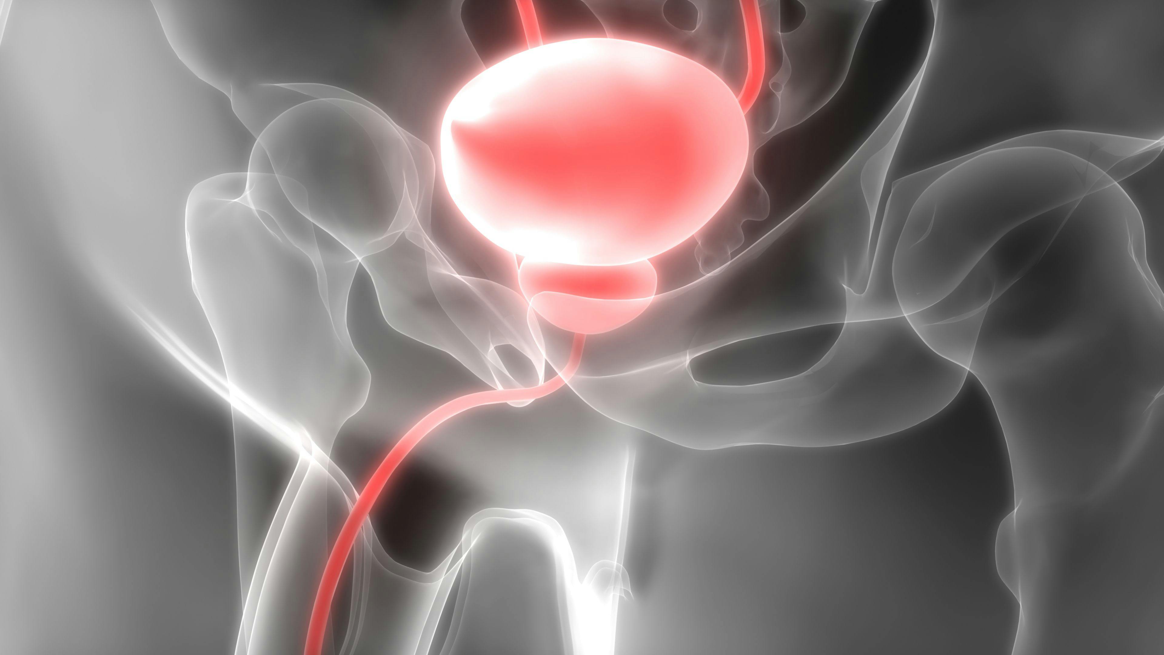 Gene Therapy for Overactive Bladder, Incontinence Shows Good Safety, Efficacy