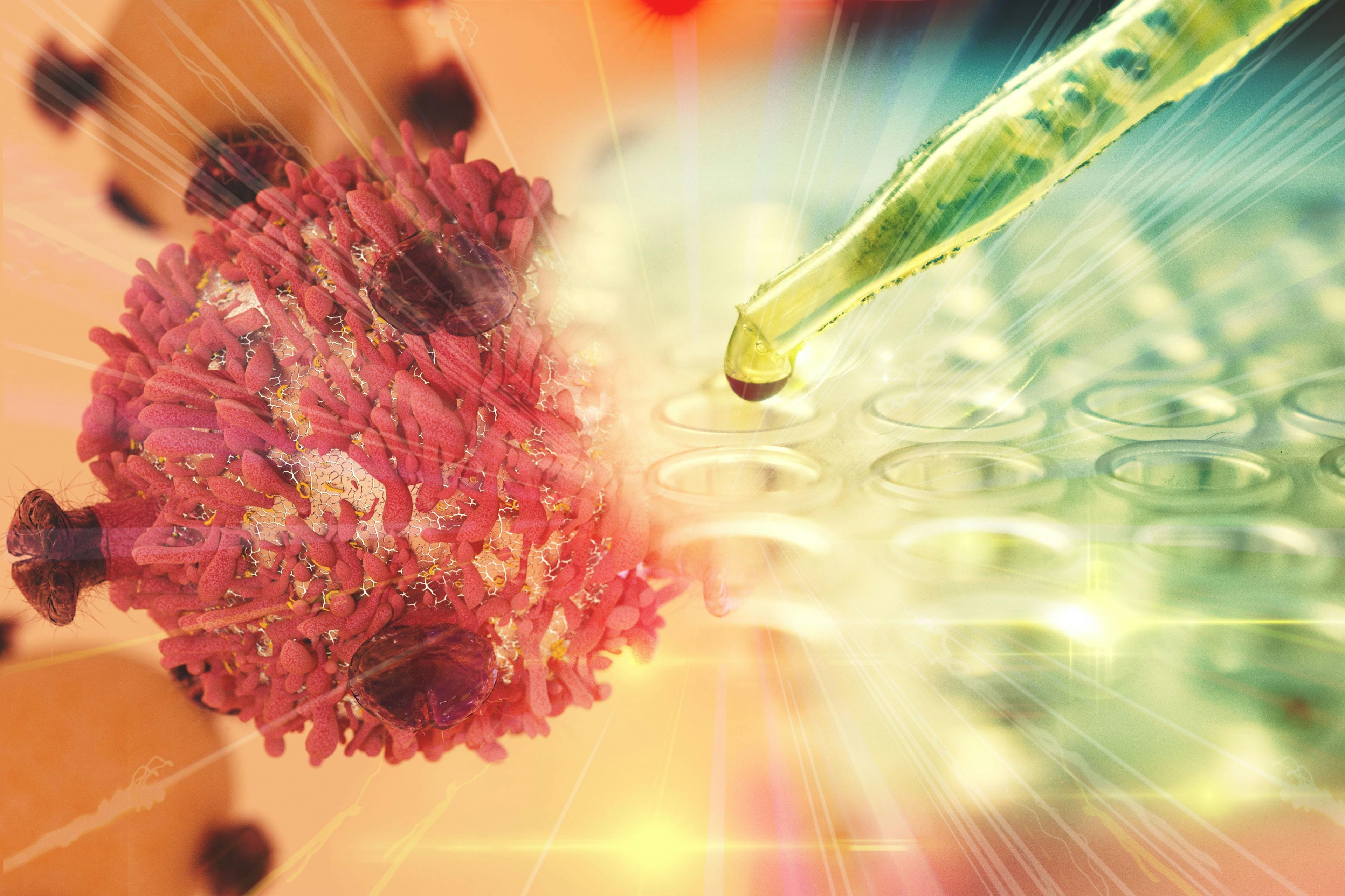 NCCN Releases CAR-T Cell Guidelines for Patients with Cancer