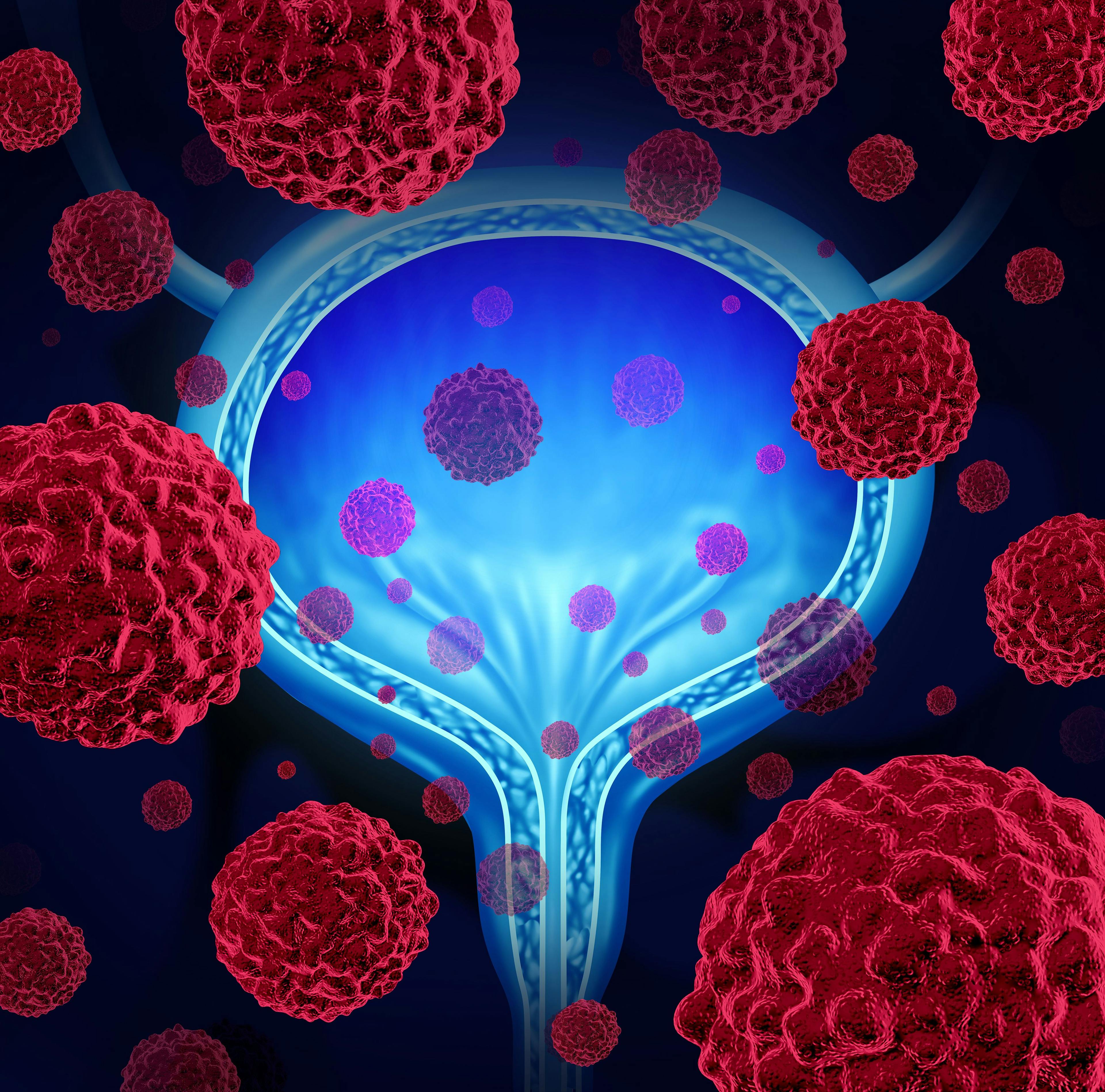 CG0070 Plus Pembrolizumab Shows Preliminary Efficacy in Non-Muscle Invasive Bladder Cancer