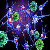 Stem Cell Therapy May Halt Multiple Sclerosis
