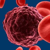 CD22 CAR T-cell Therapy Effective After CD19 CAR Therapy Failure in Children With B-ALL