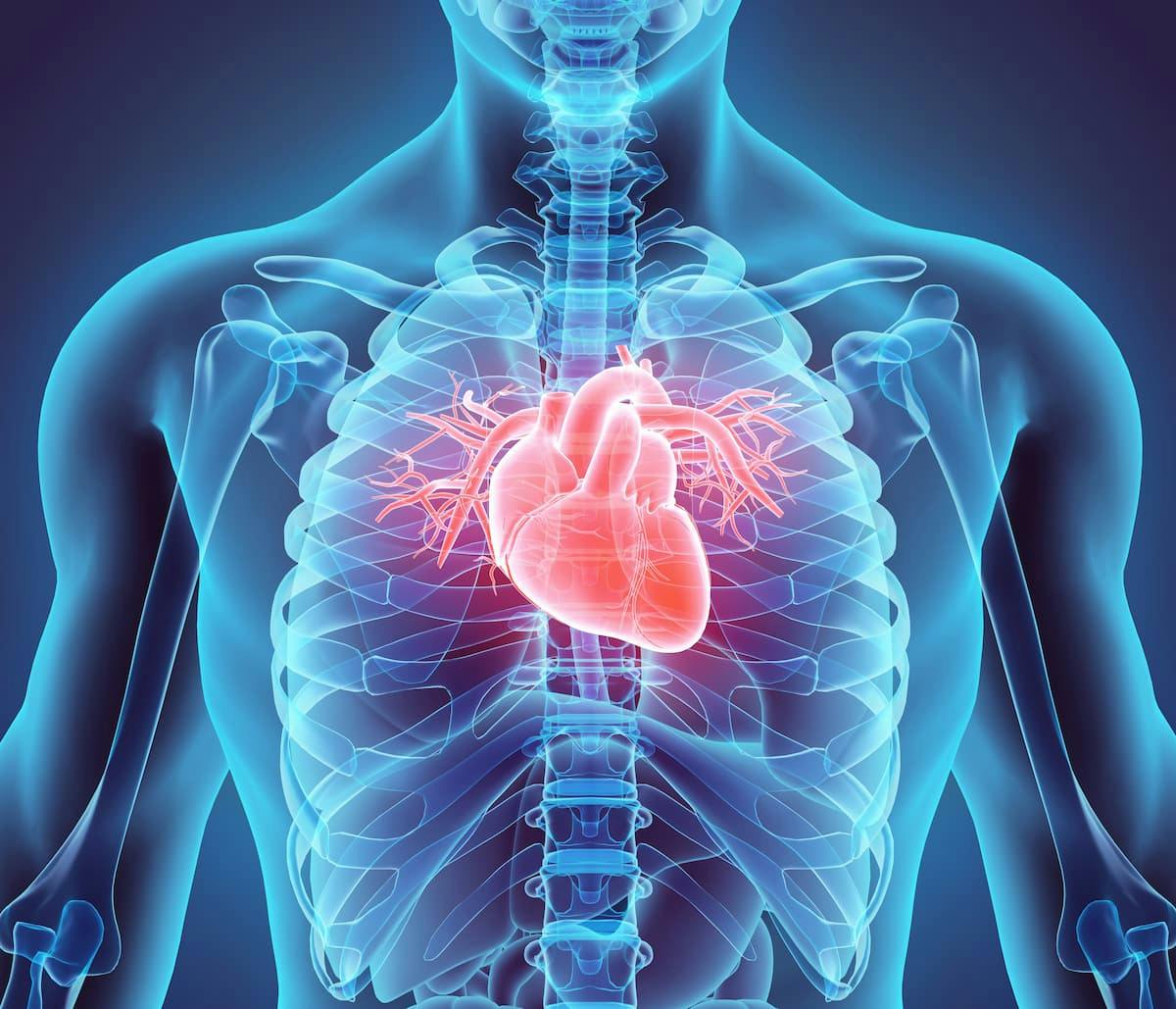 BioCardia Likely to Miss the Mark in Phase 3 CardiAMP Heart Failure Cell Therapy Trial