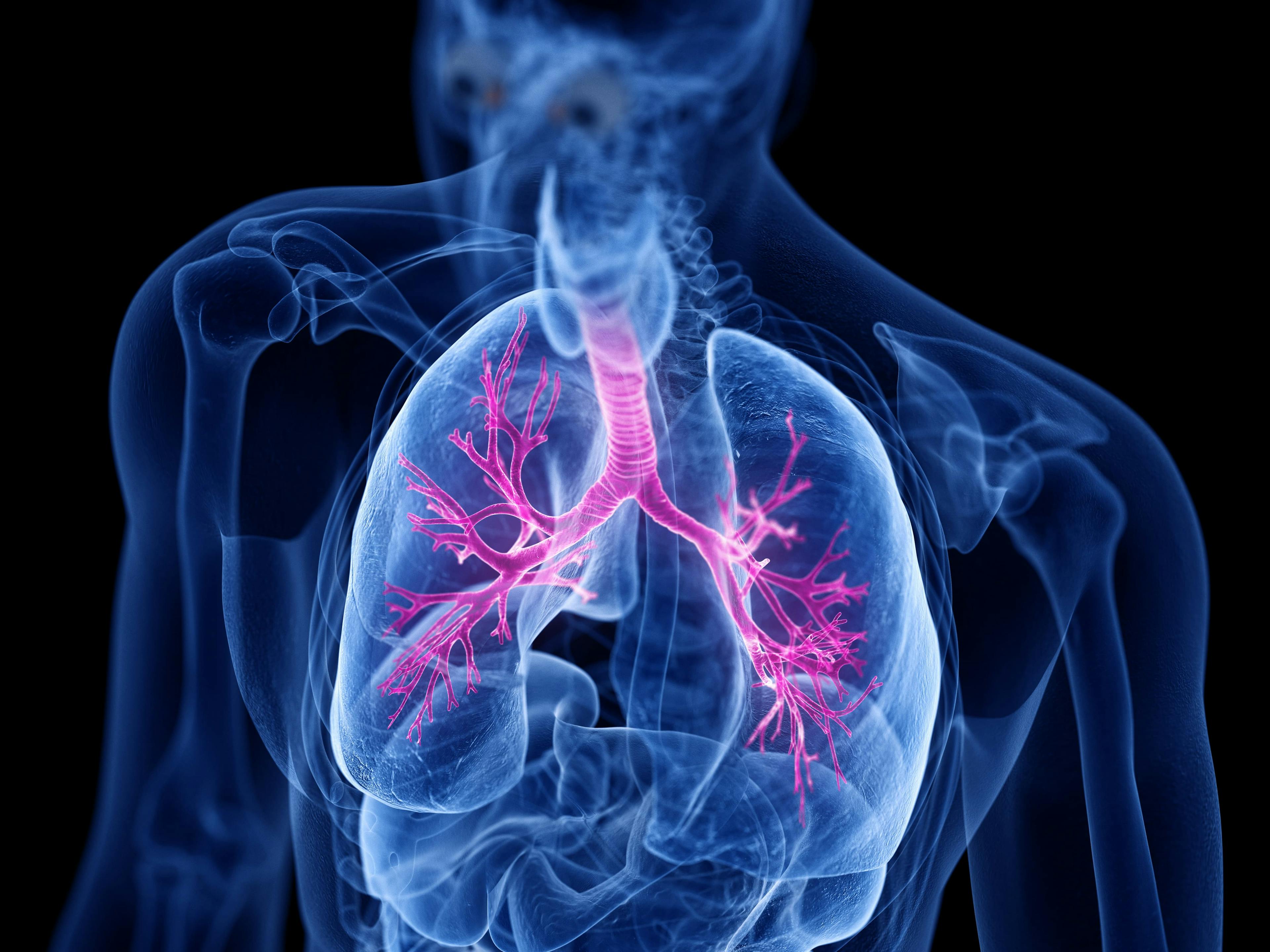 Cystic Fibrosis Gene Therapy Well-Tolerated, Yields Transgene Expression in All 7 Participants 