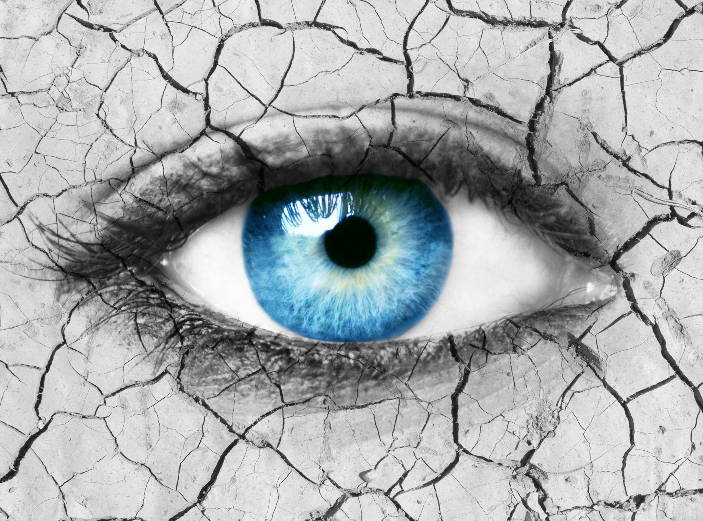 Stem Cell-Derived Eye Drops Improve Outcomes in Dry Eye Disease