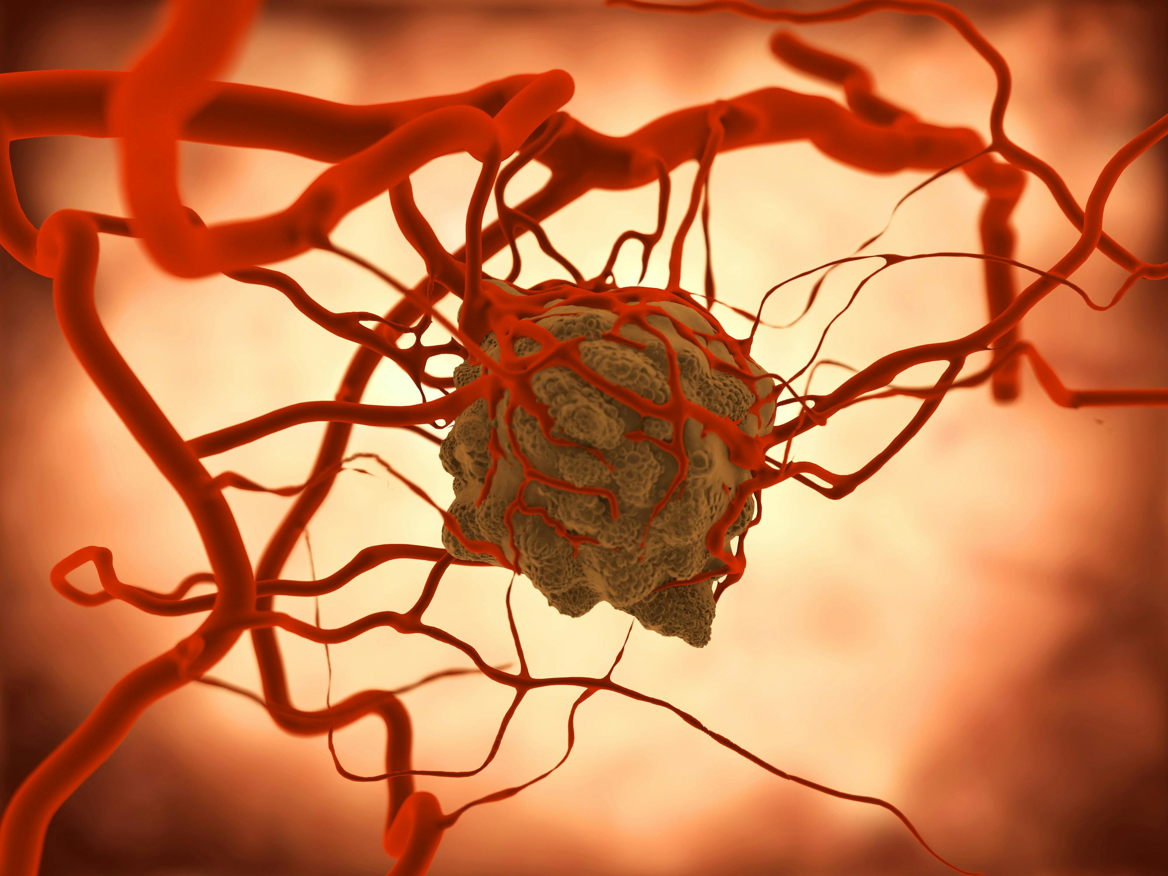 First In-Human Study Initiated for CAR Macrophage Cell Therapy for Solid Tumors 