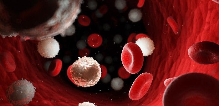 Allogeneic T-cell Progenitor Therapy Trial Doses First Patient With Leukemia 