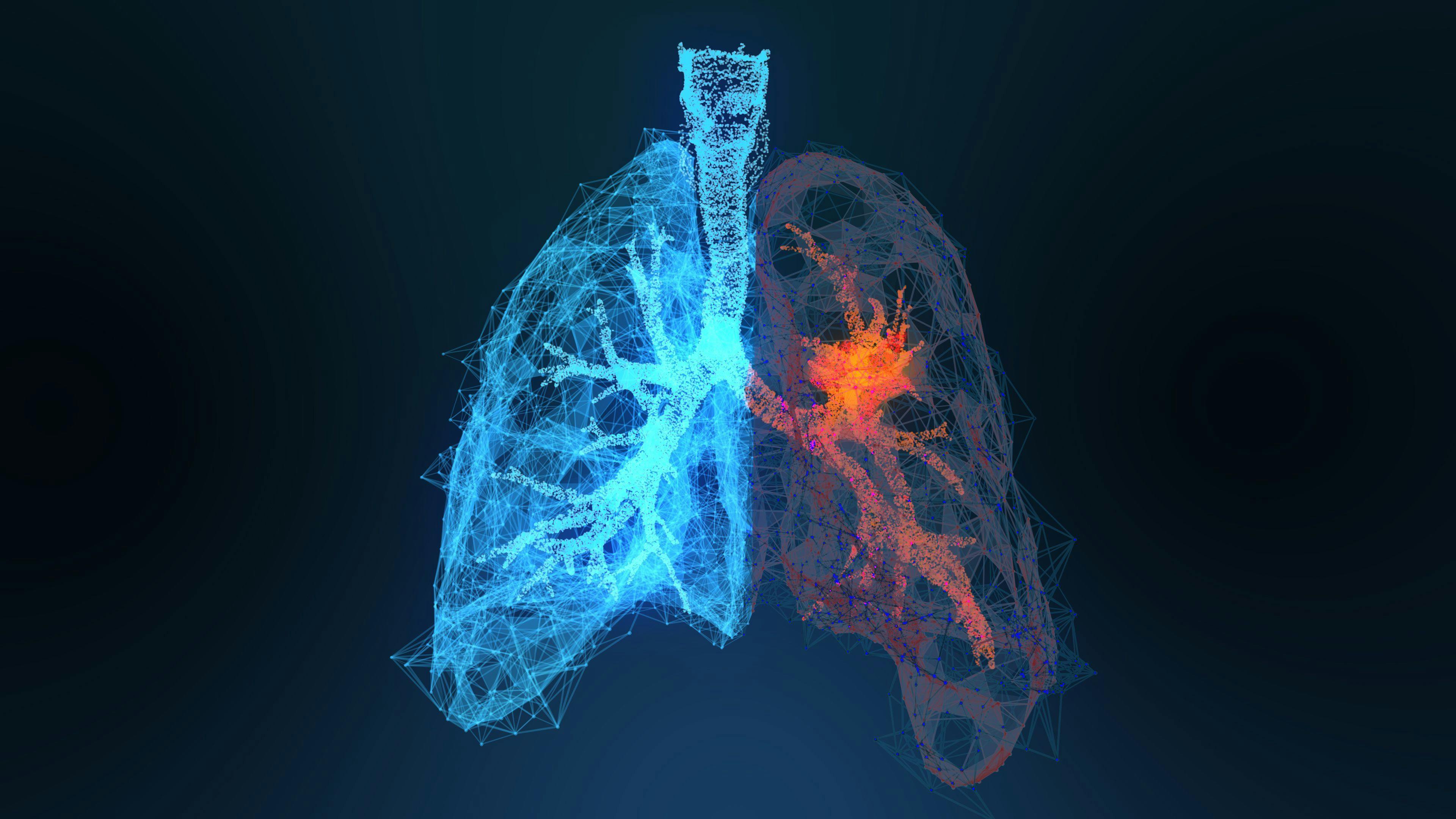 Genprex to Evaluate Higher Dose of REQORSA in NSCLC 