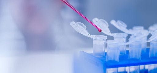 Neutralizing Antibody Versus Total Antibody Assays in Gene Therapy Development: Key Considerations for Assessing Immunogenicity
