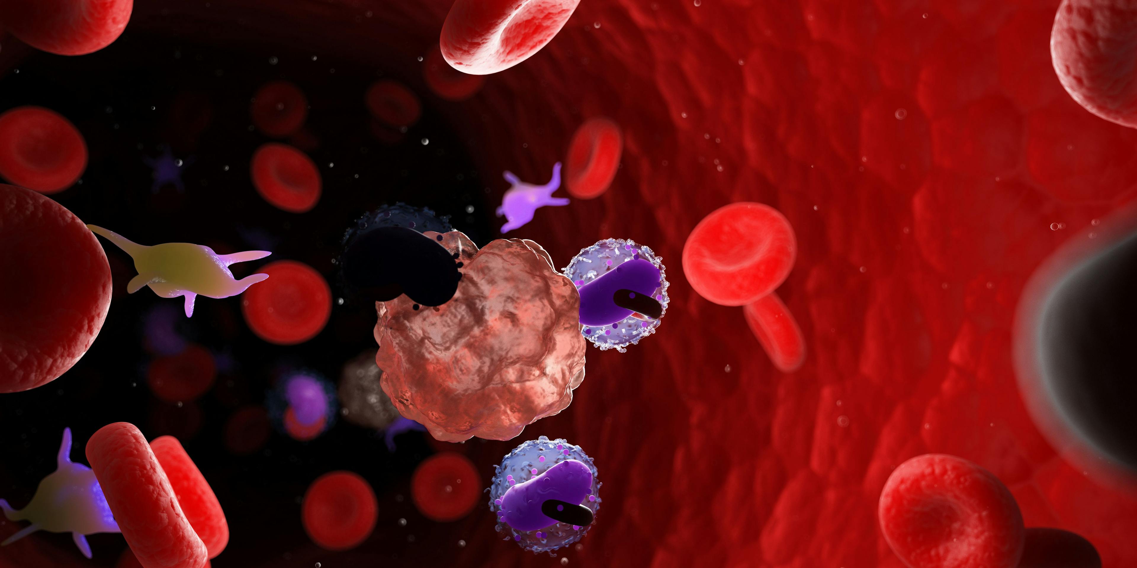 Dual-Targeted CAR T Therapy Efficacious in Relapsed/Refractory B-Cell Malignancies
