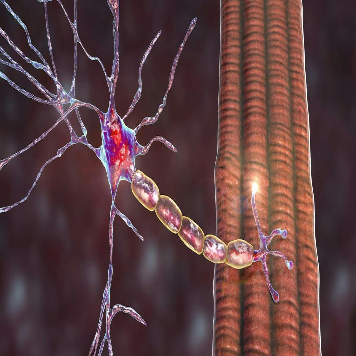 Astrocyte Cell Therapy Temporarily Slows ALS Decline
