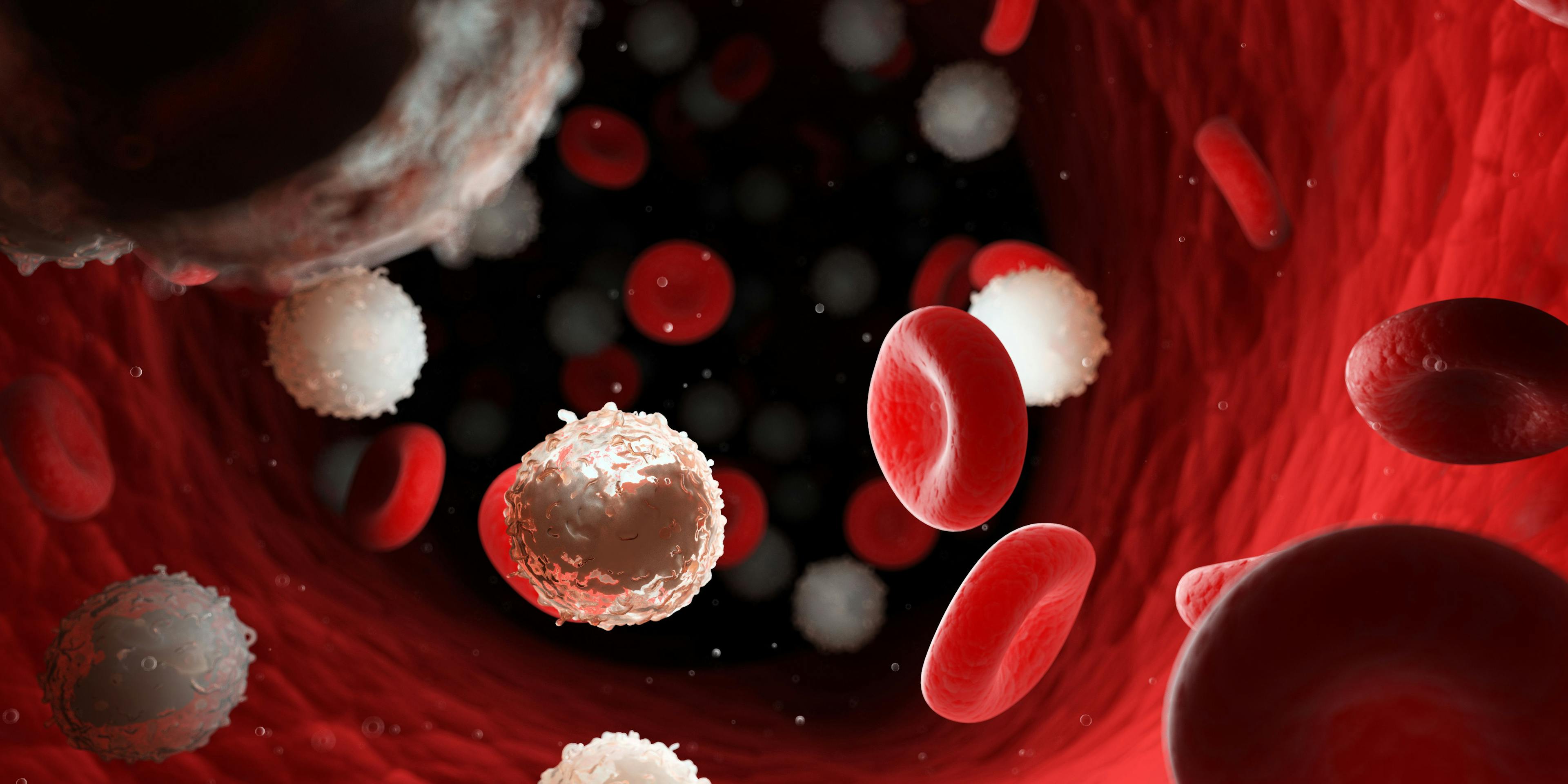 Brexucabtagene Autoleucel Approved for Refractory B-Cell Acute Lymphoblastic Leukemia