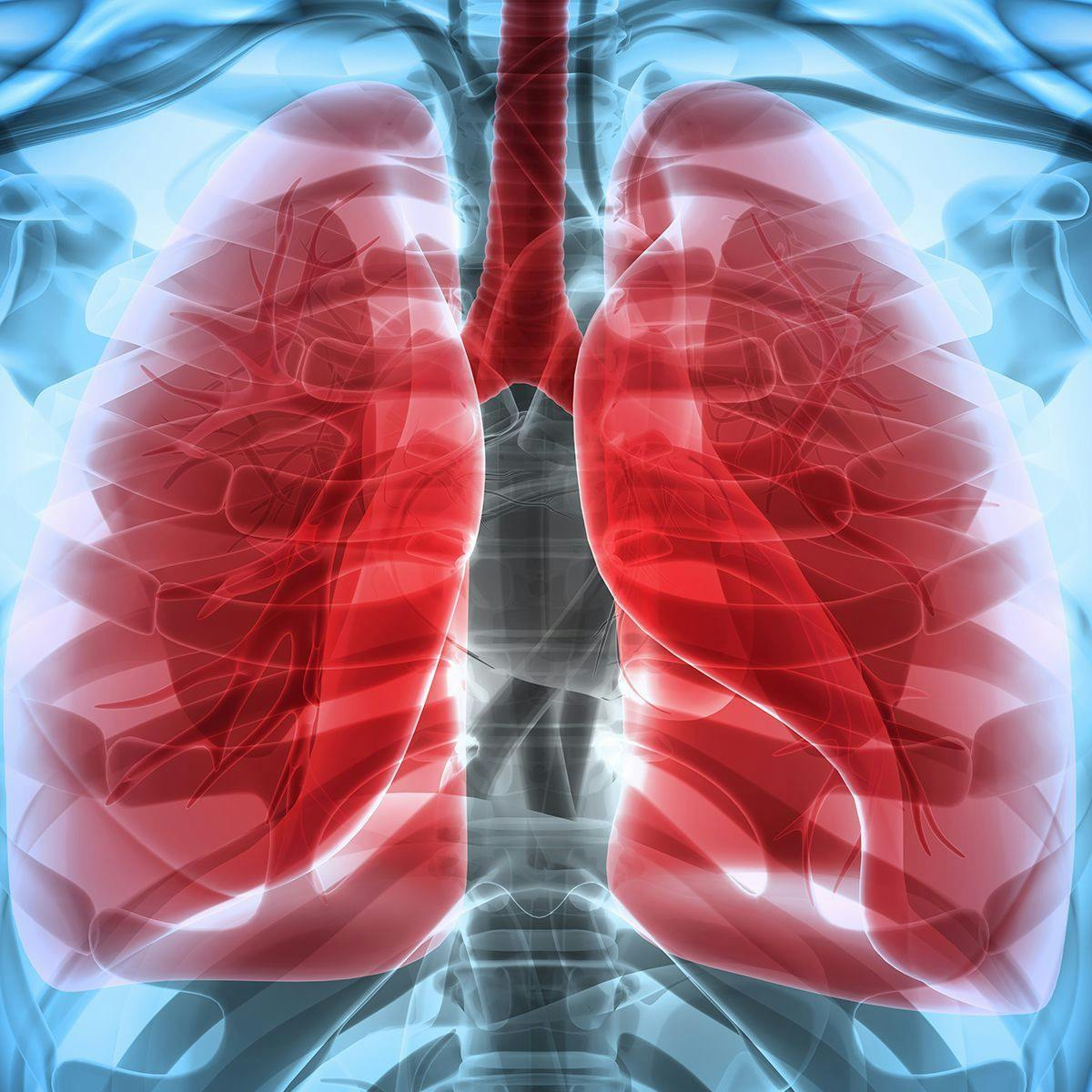 Growth of Targeted Therapy Requires More Nuanced Treatment Considerations in NSCLC