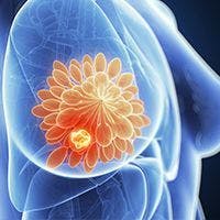 TIL Therapy Cleared to Begin Clinical Trial for Patients with Advanced Solid Tumors 