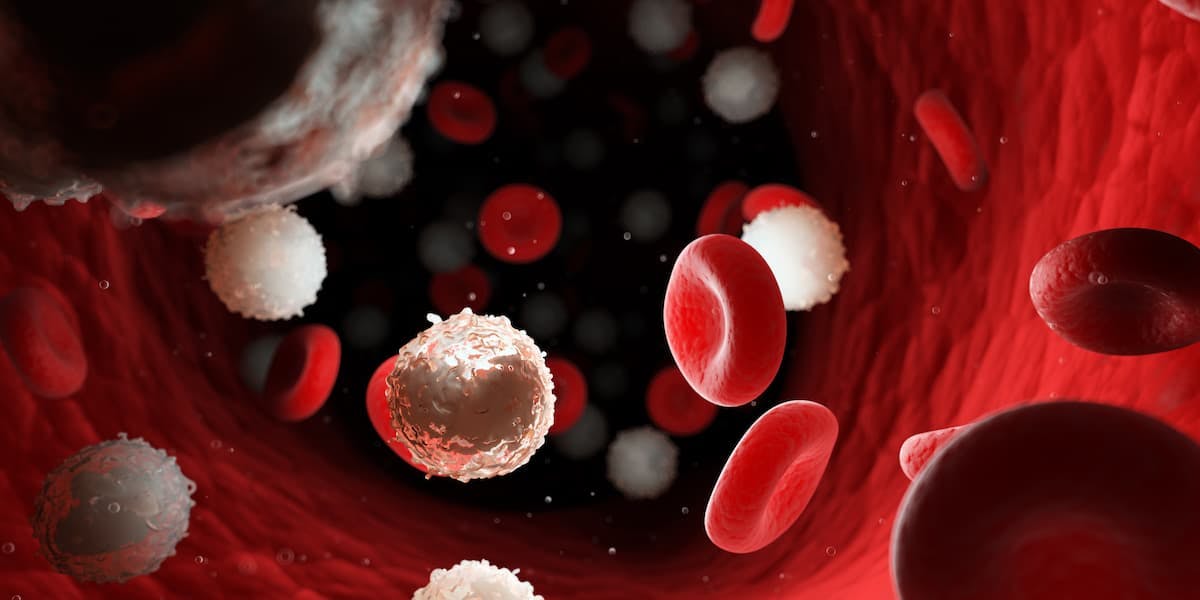 Base-Edited CD7-CAR T Cells Show Early Efficacy in T-ALL