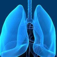 DUBLIN-3 Trial With Plinabulin in Advanced NSCLC to Continue Without Modifications